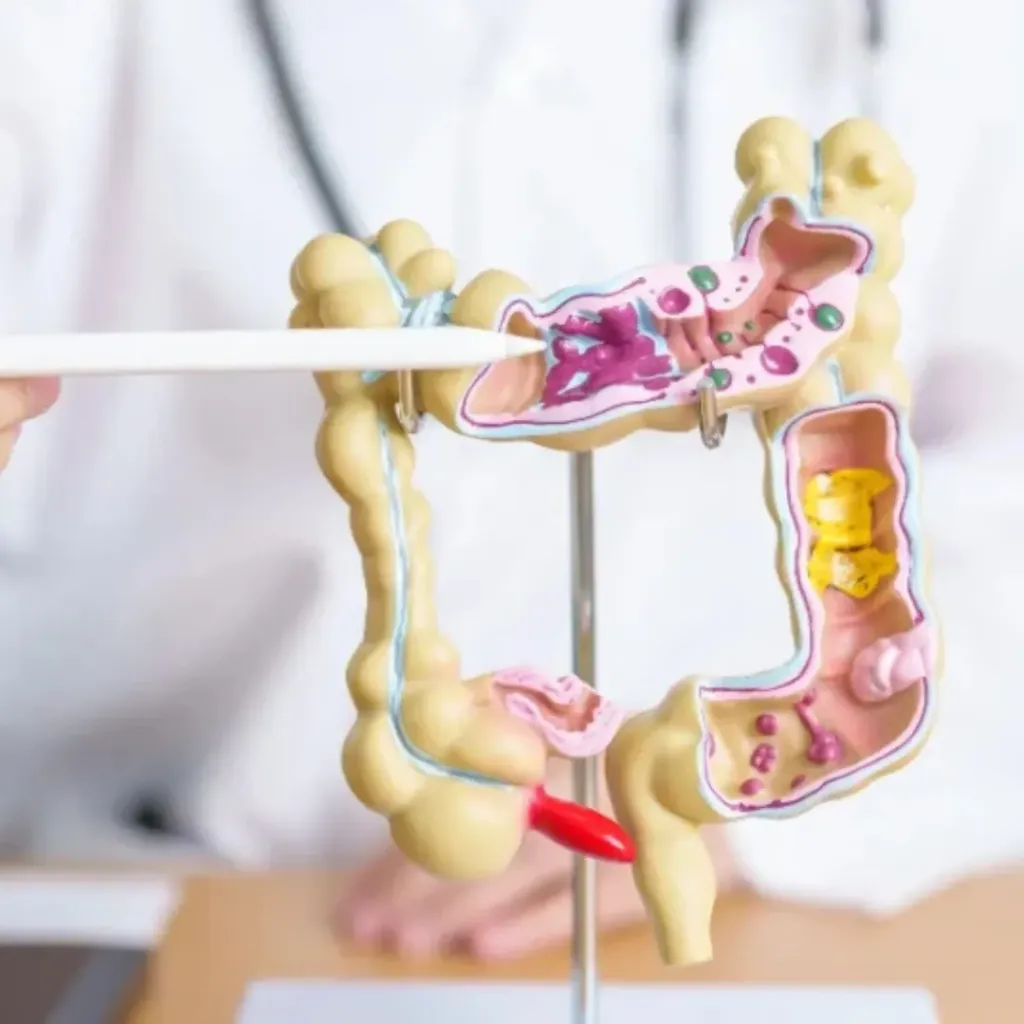 Hidroterapia de colon